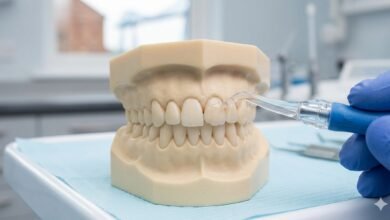 Common Misunderstandings About Composite Bonding Middlesbrough