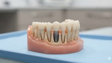 A Stable Way to Replace Missing Teeth With Dental Implants Newcastle